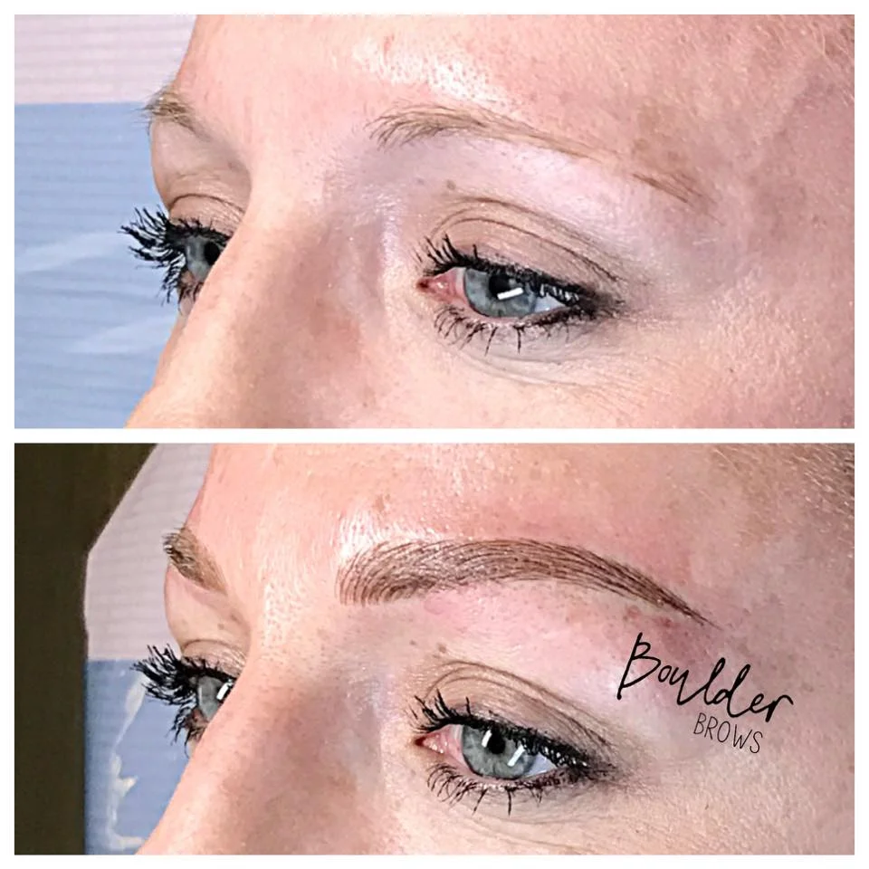 Top: Before | Bottom: After Microblading