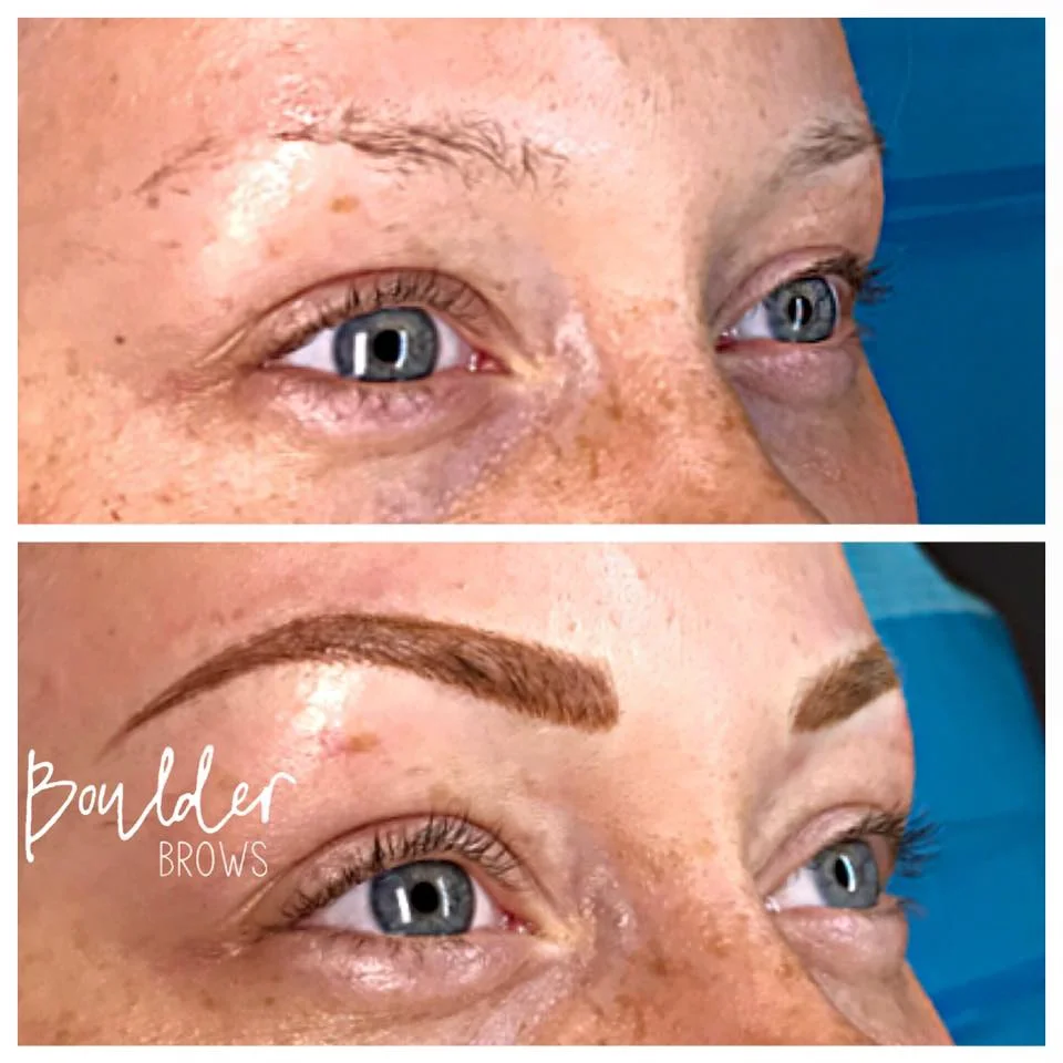 Top: Before | Bottom: After Microblading