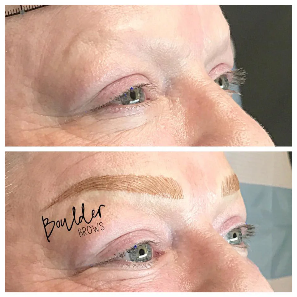 Top: Before | Bottom: After Microblading
