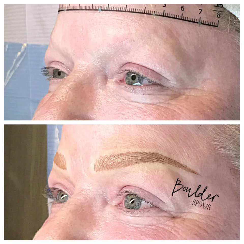 Top: Before | Bottom: After Microblading