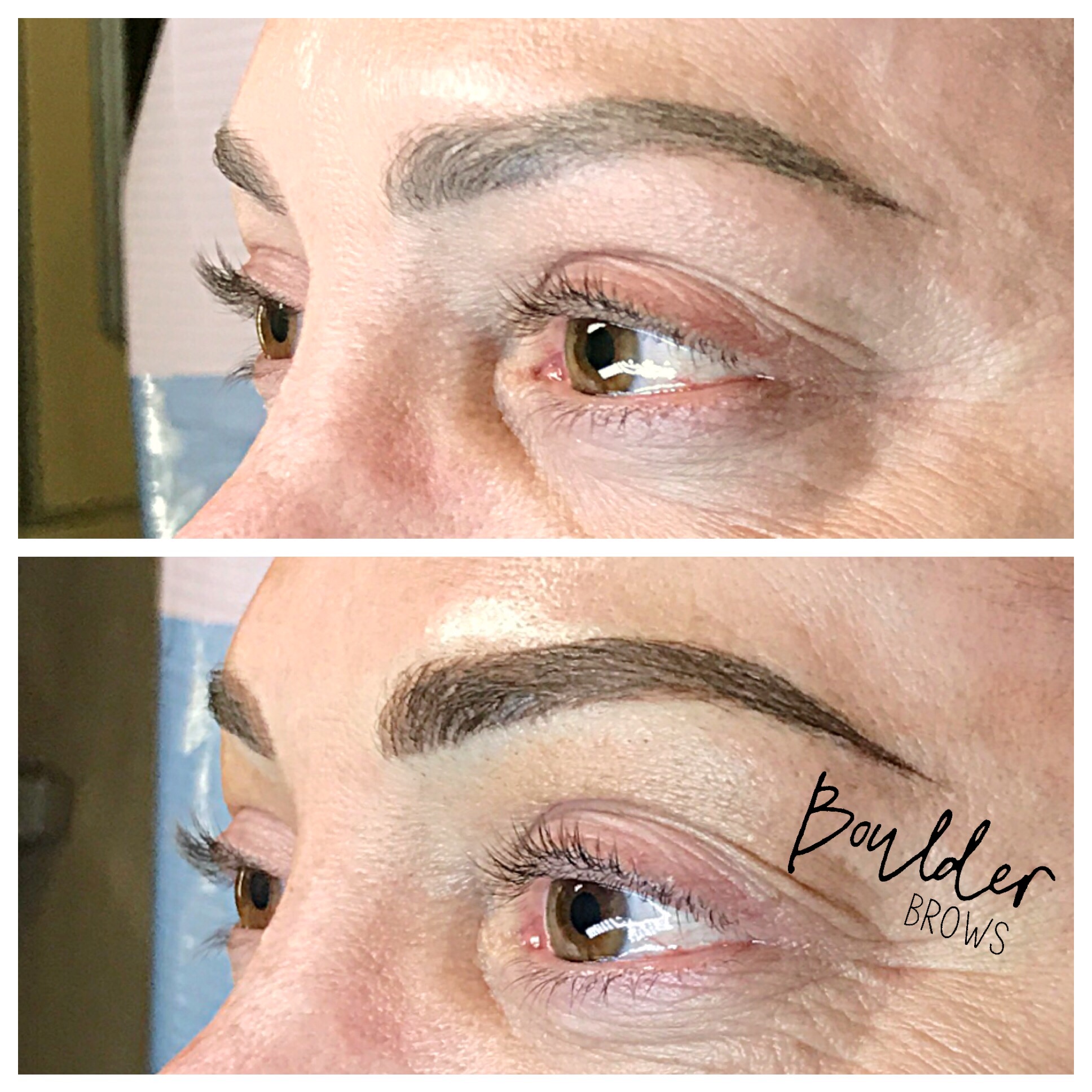 Top: Healed After 1st Session | Bottom: After Touchup