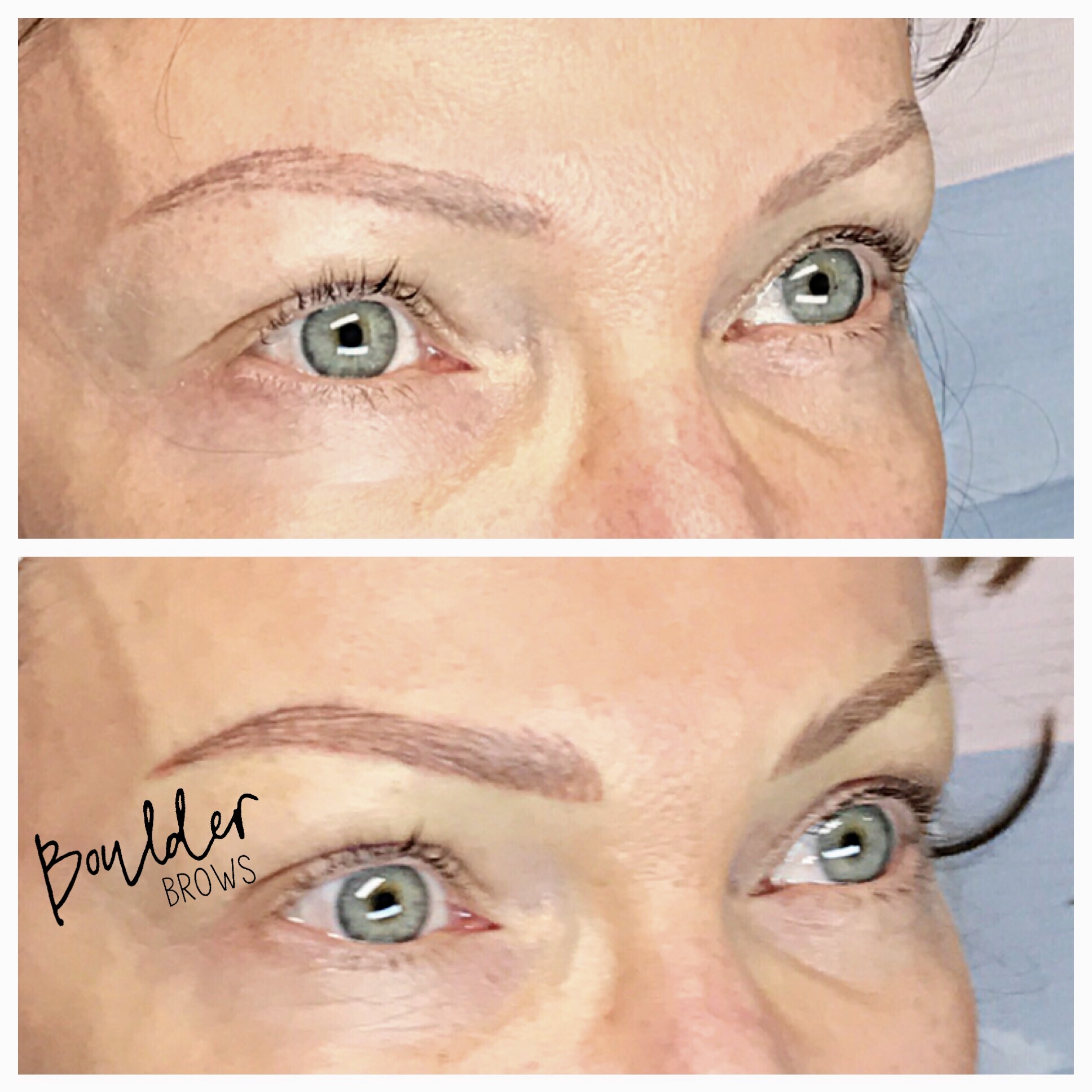 Top: Healed After 1st Session | Bottom: Immediately After Touchup