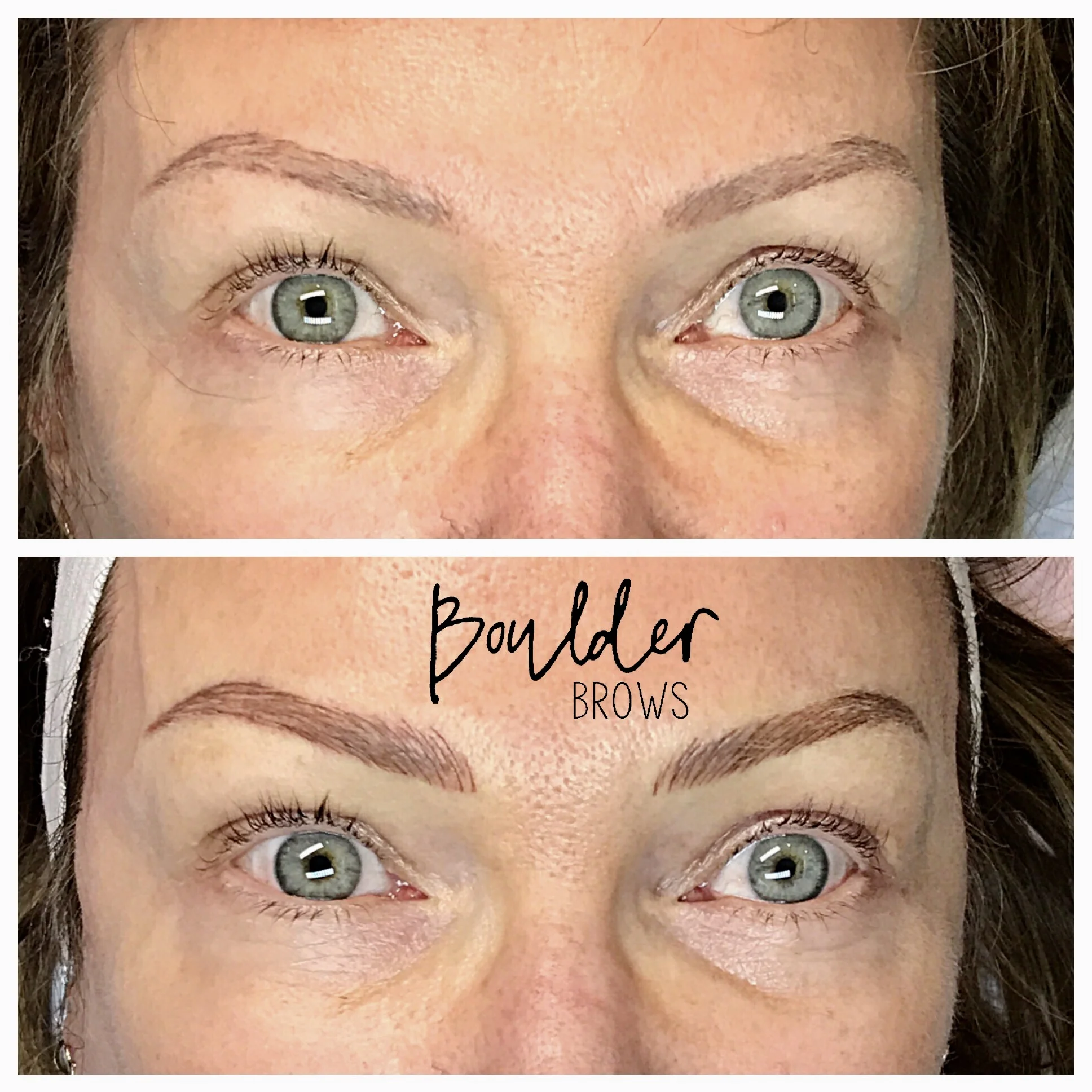 Top: Healed After 1st Session | Bottom: Immediately After Touchup