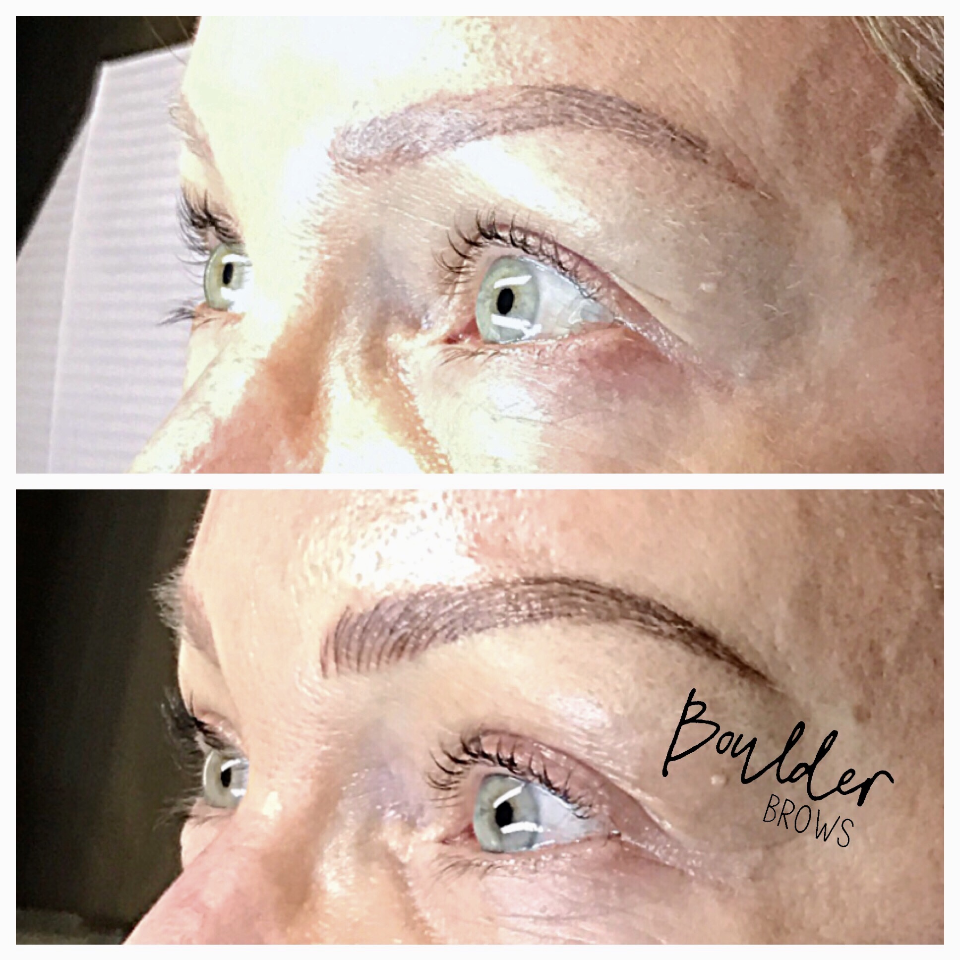 Top: Healed After 1st Session | Bottom: Immediately After Touchup
