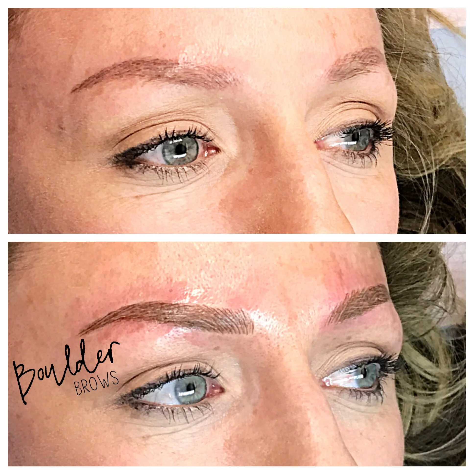 Top: Healed After 1st Session | Bottom: Immediately After Touchup