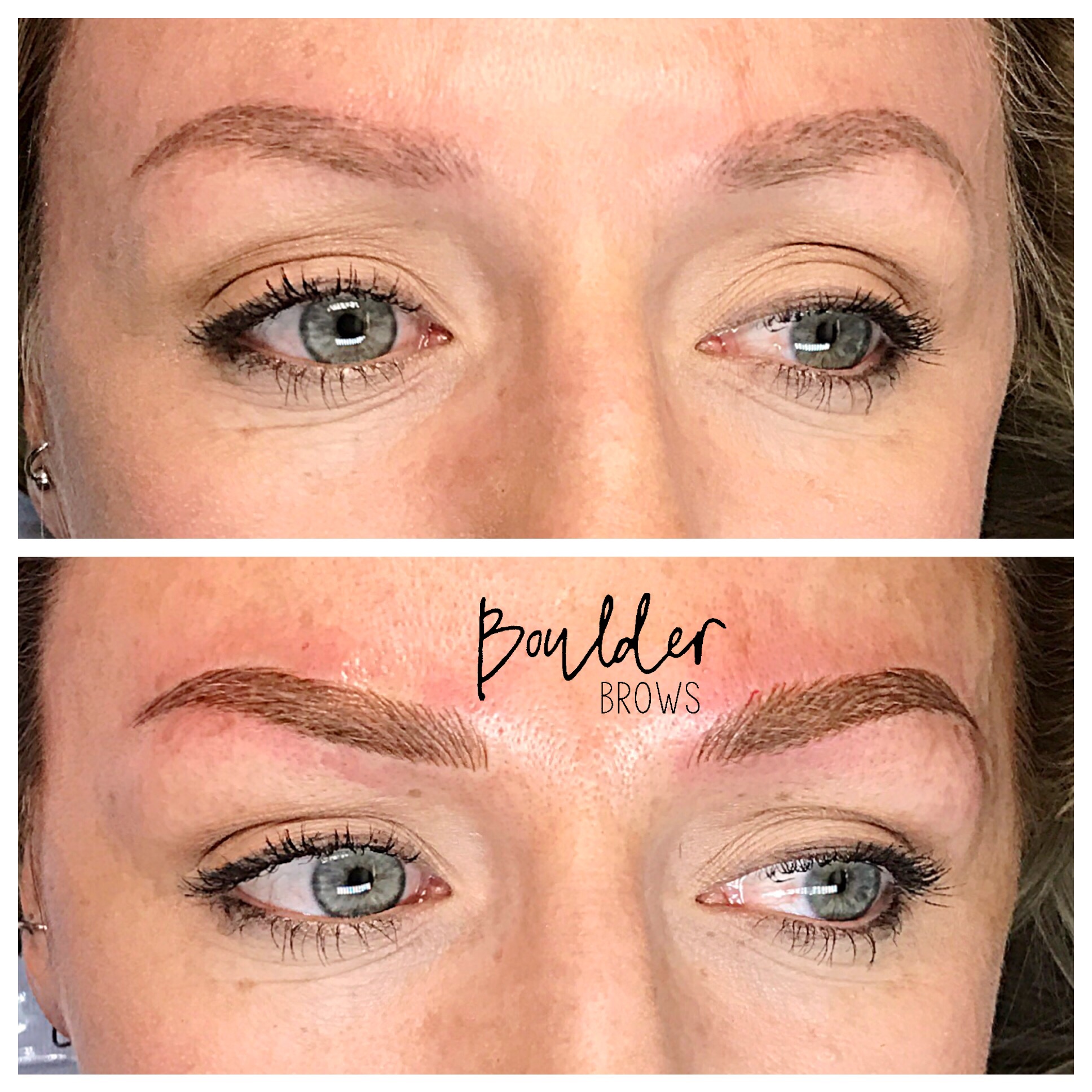 Top: Healed After 1st Session | Bottom: Immediately After Touchup