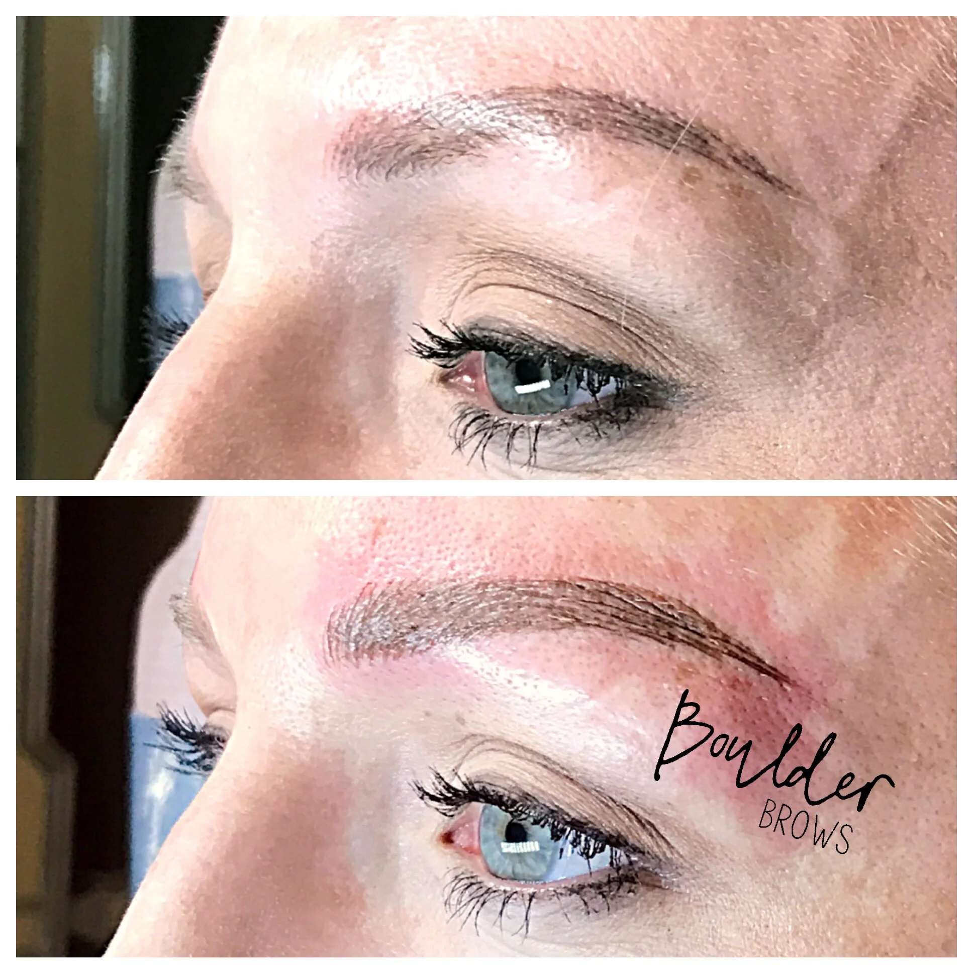 Top: Healed After 1st Session | Bottom: Immediately After Touchup