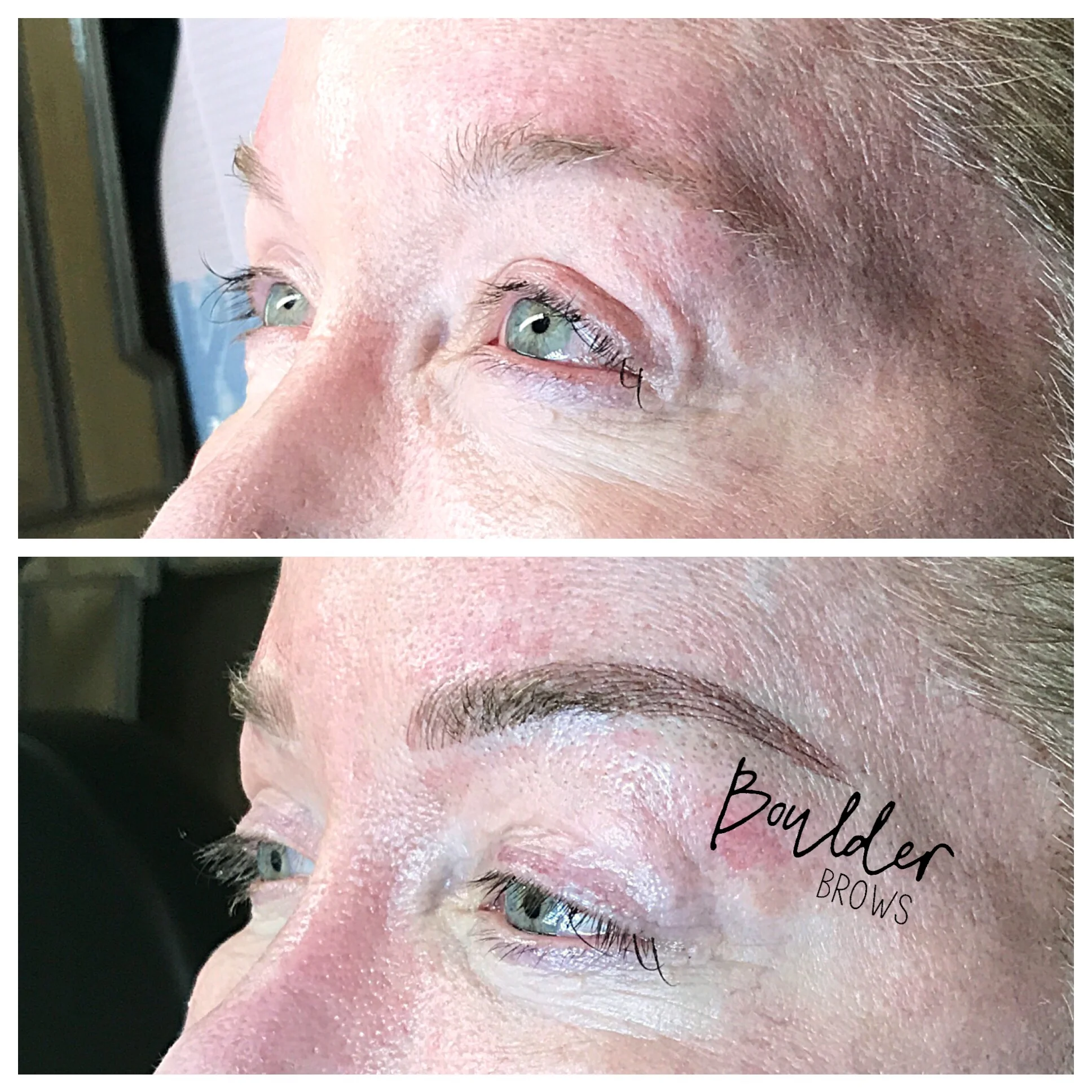Top: Before | Bottom: After Microblading