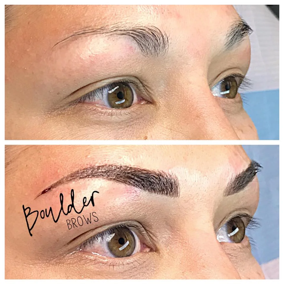 1ST MICROBLADING SESSION Top: Before | Bottom: After