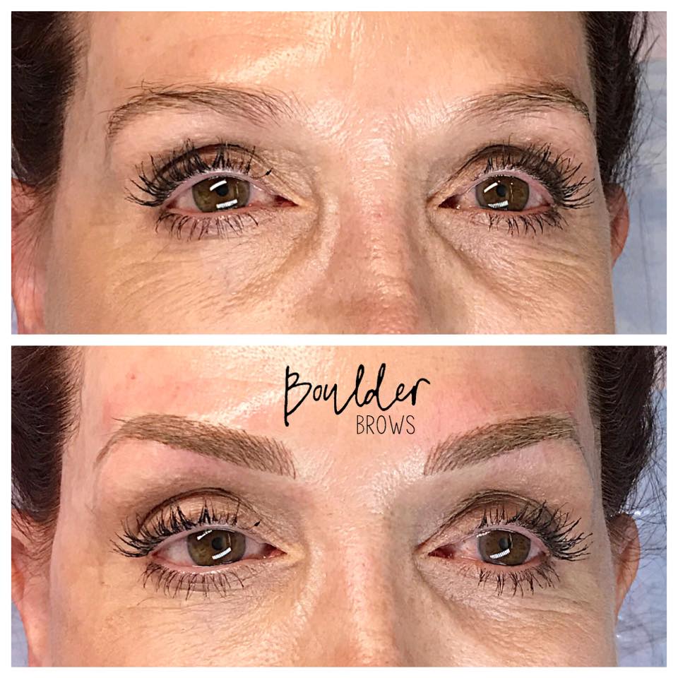 Top: Before | Bottom: After Microblading