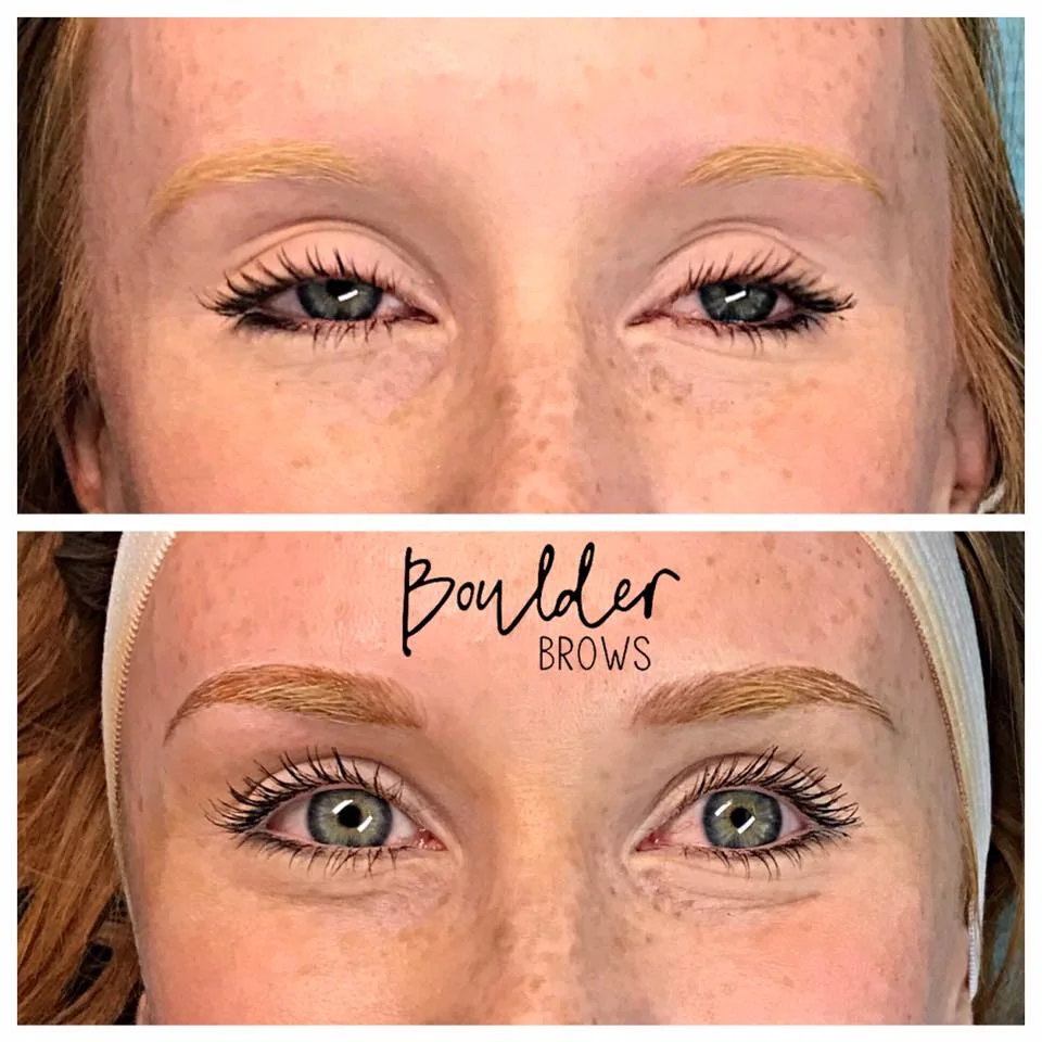 1ST MICROBLADING SESSION Top: Before | Bottom: After