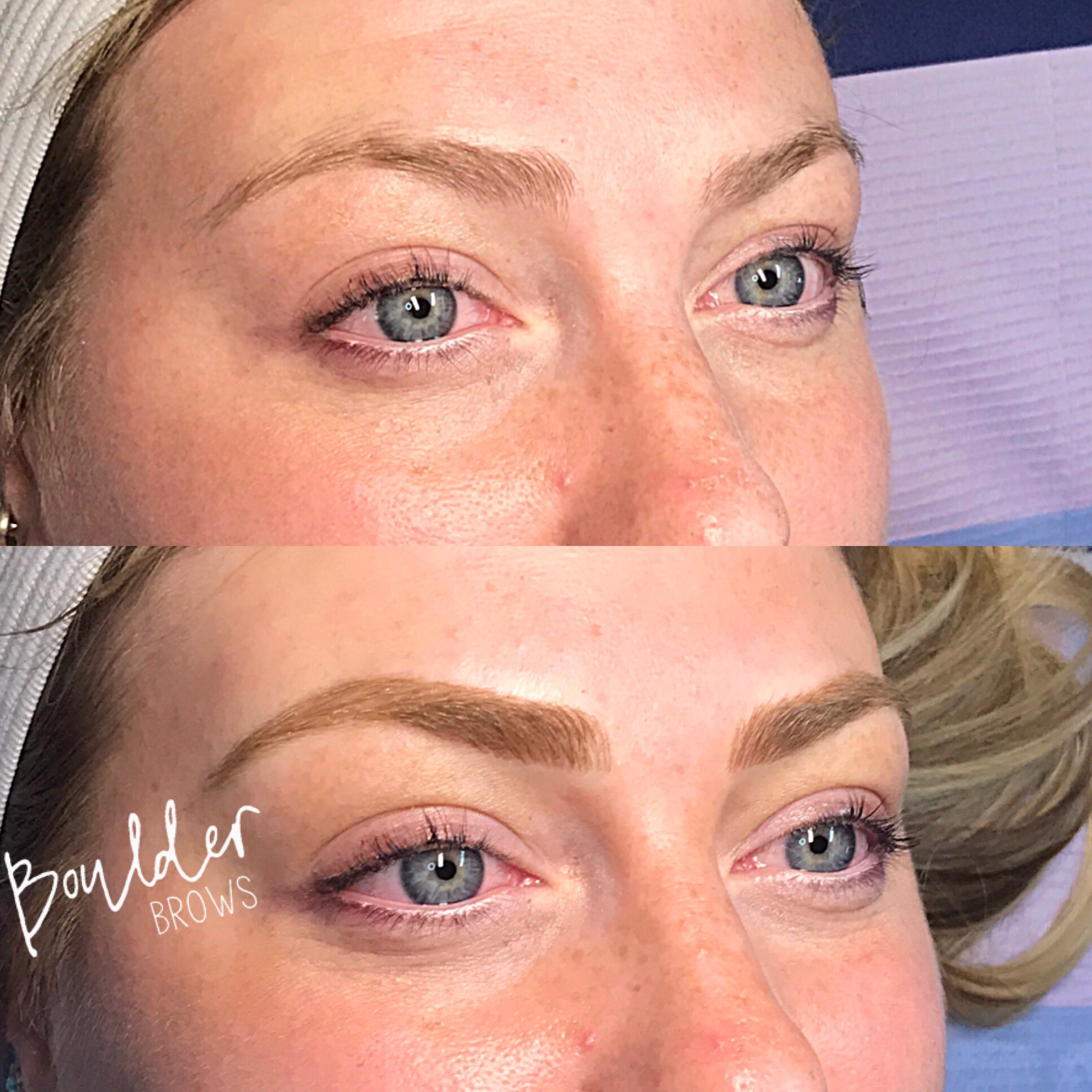 1ST MICROBLADING SESSION Top: Before | Bottom: After