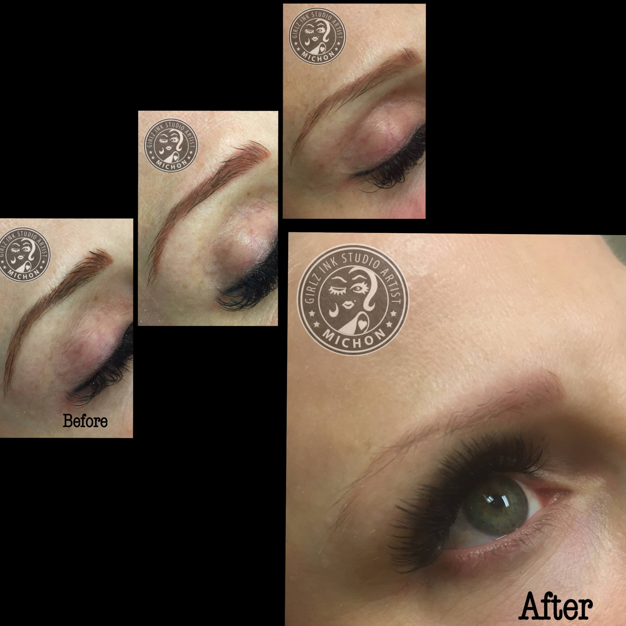 Process of 3 Removal Sessions