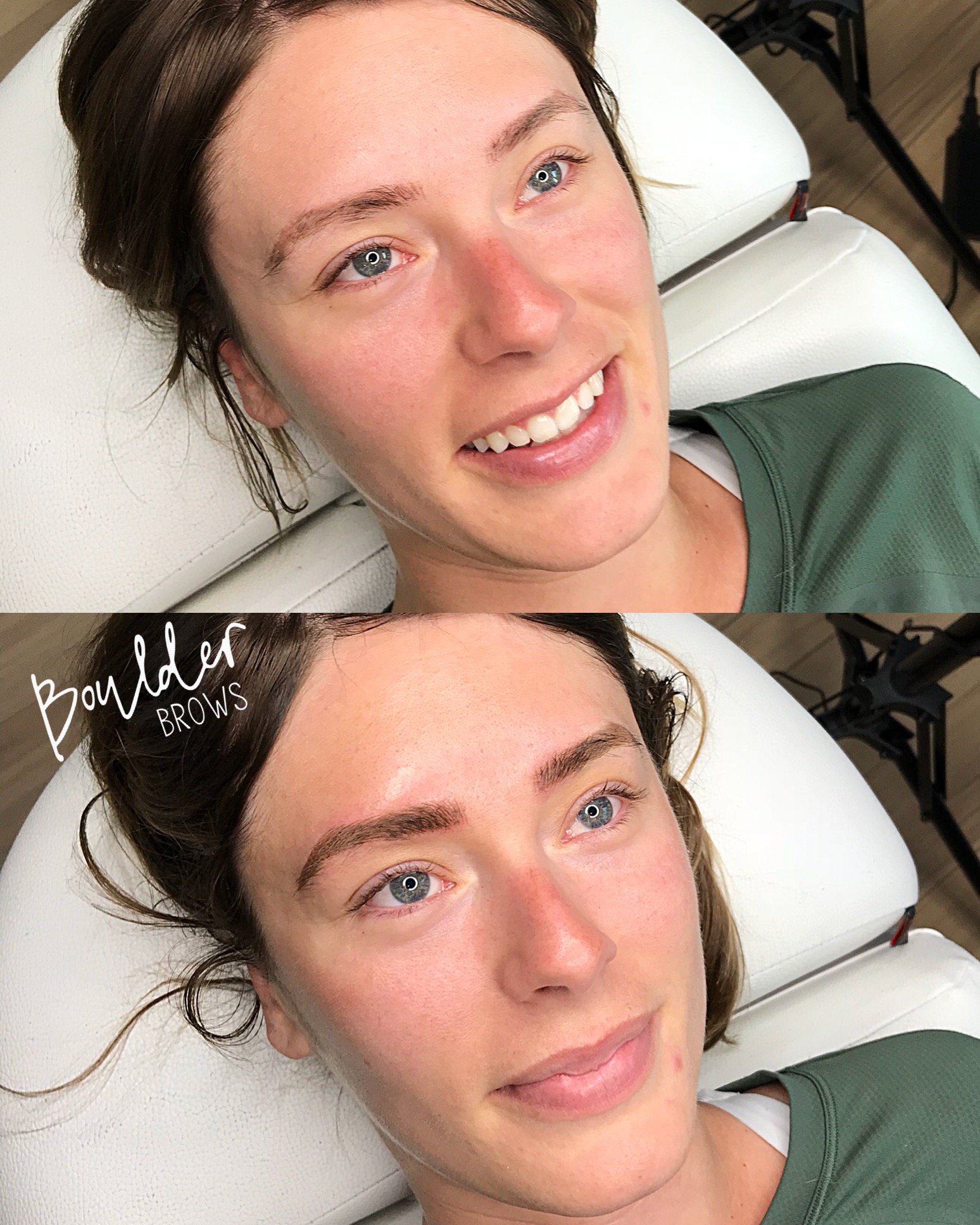 EARLY REFRESH SESSION BY JESS Top: Healed | Bottom: Immediately After