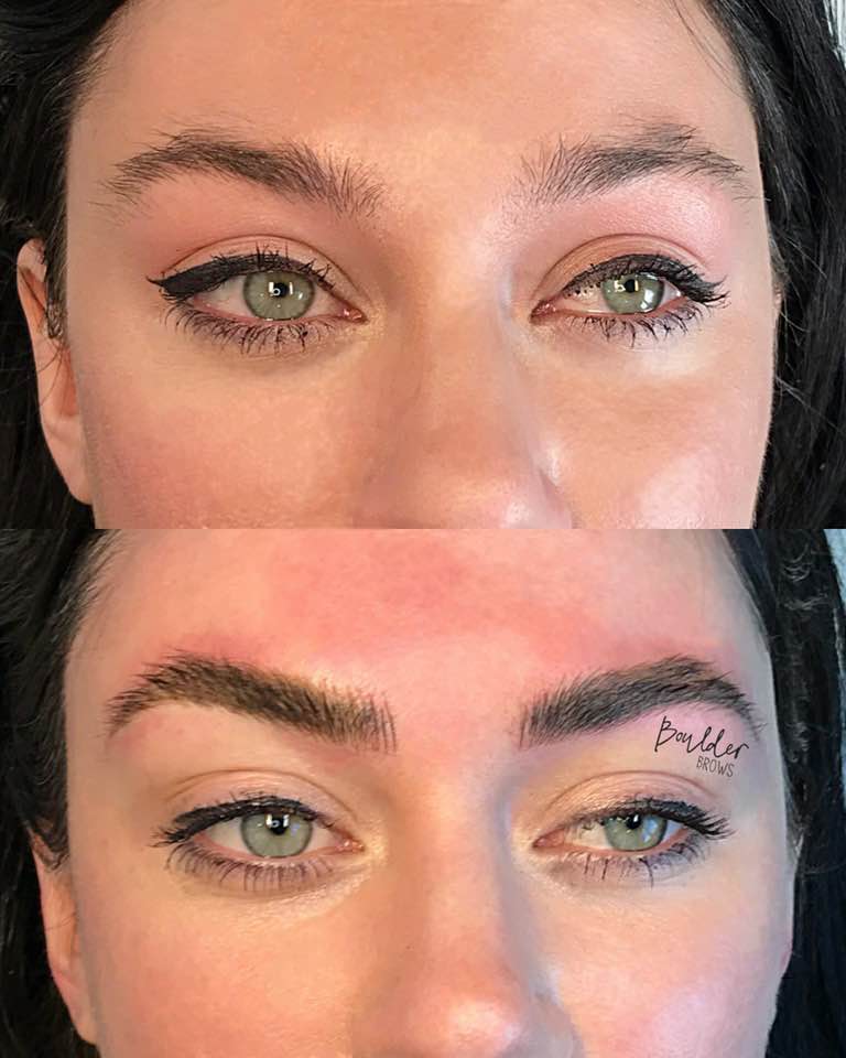 1ST MICROBLADING SESSION BY JESS Top: Before | Bottom: After