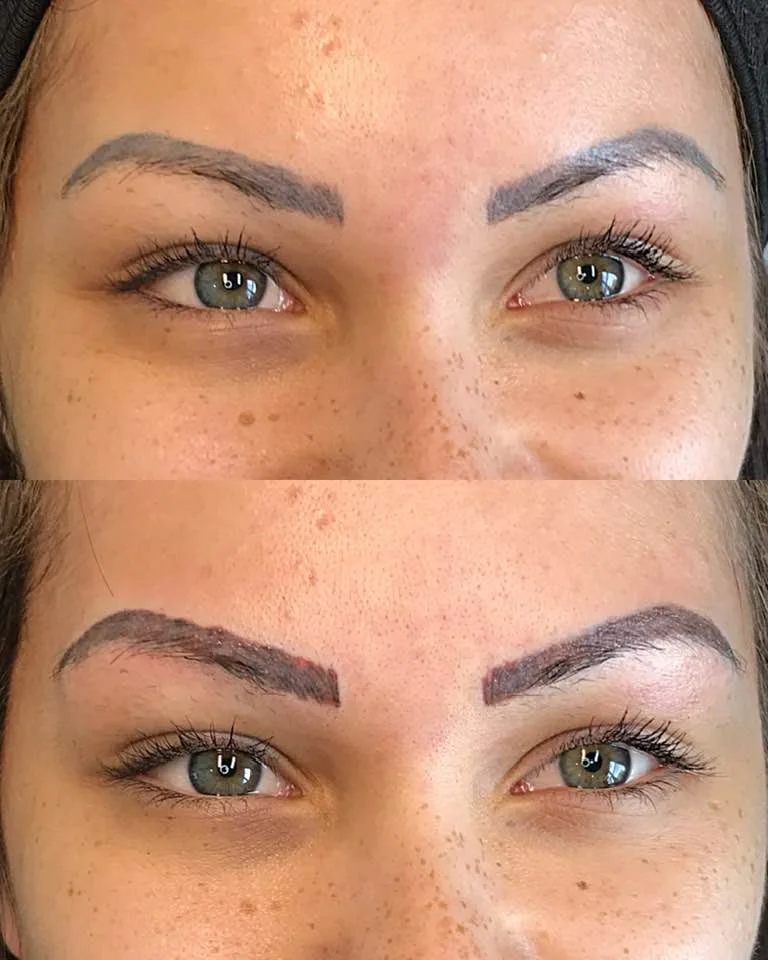 1ST REMOVAL SESSION BY JESS Top: Before | Bottom: After