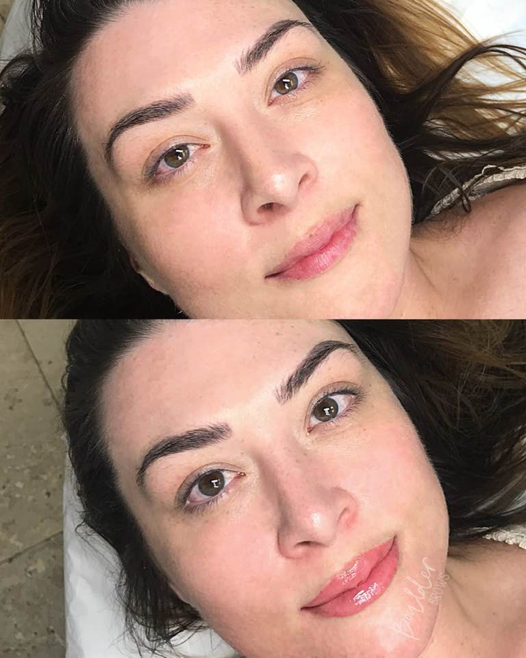 1ST LIP SESSION BY JESS Top: Before | Bottom: After