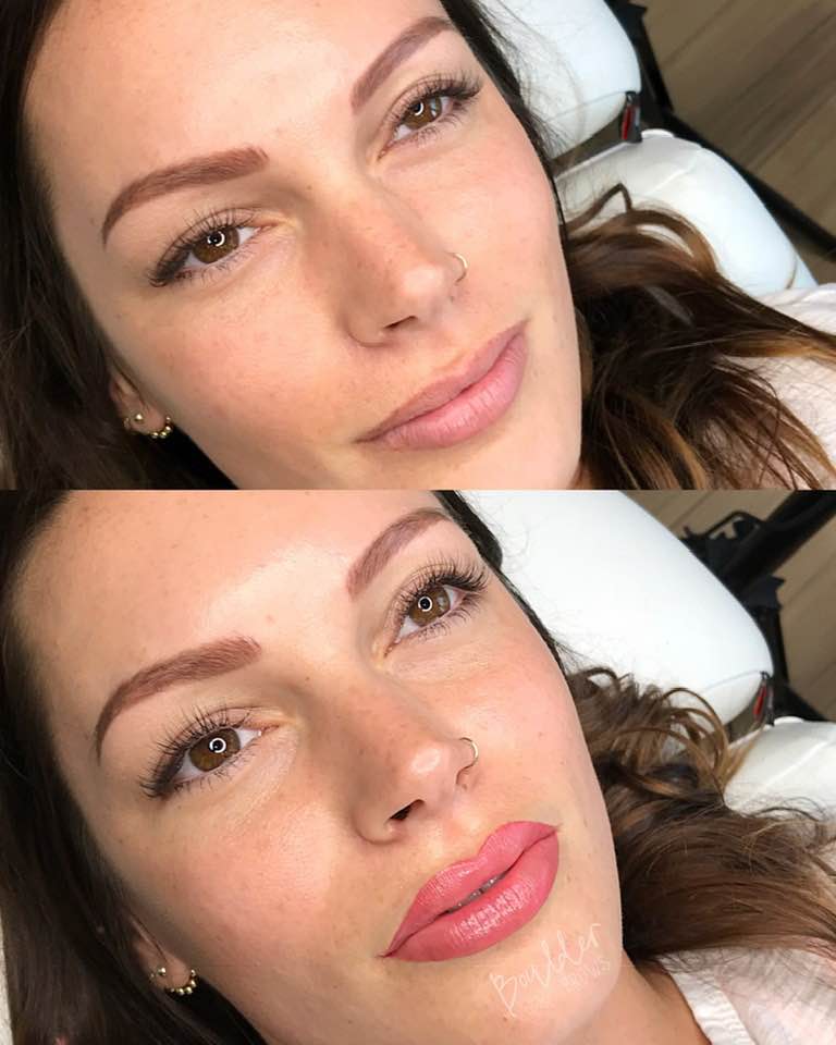 1ST LIP SESSION BY JESS Top: Before | Bottom: After