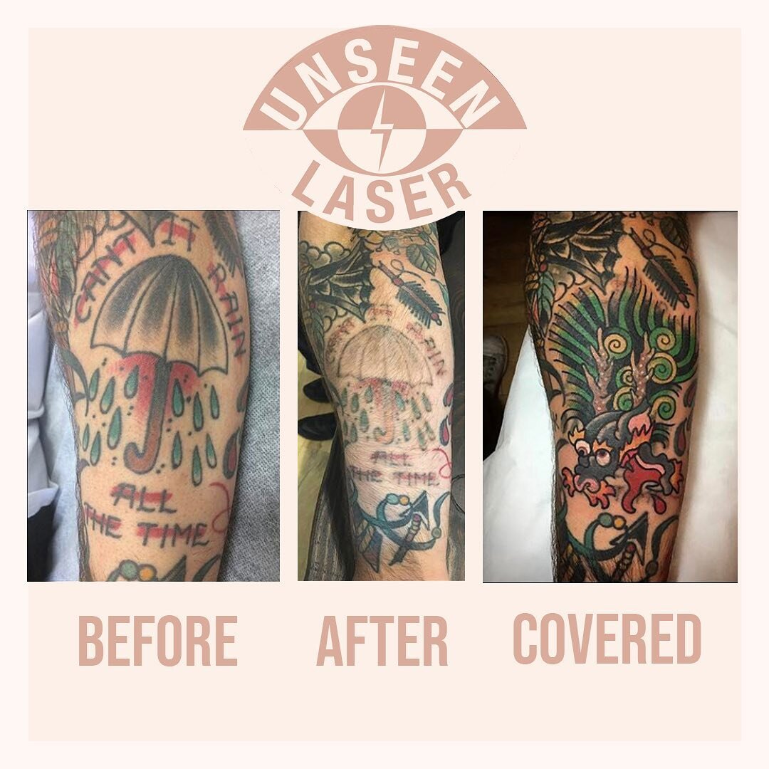 Before and after with a cover up by @giacomo.unseen. To learn more about laser or how you can cover an old tattoo get in touch today!