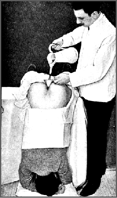 Colonic Hydrotherapy Through History