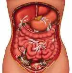 Scar Tissue Ruining Your Life?