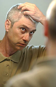 Saw Palmetto for Male Pattern Baldness