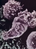 Cancer-Cells.jpg