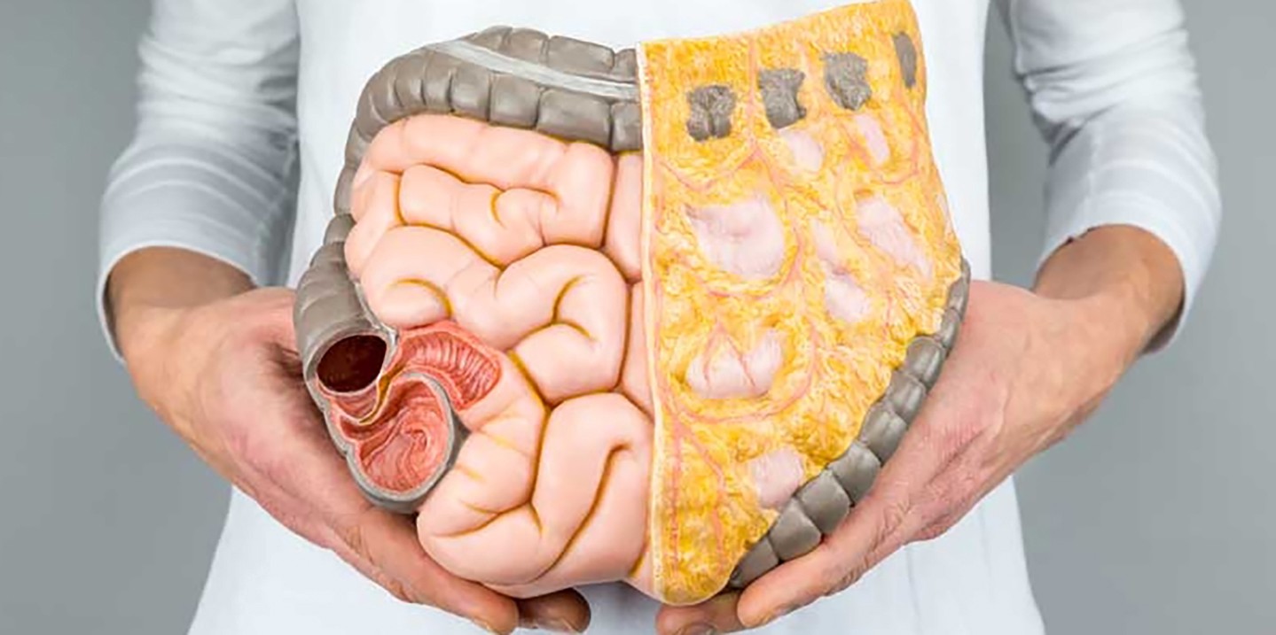 Visceral fat accumulation.jpeg