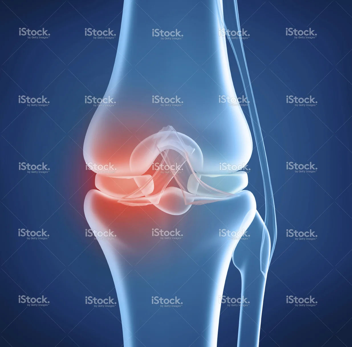 knee--x-ray.jpg