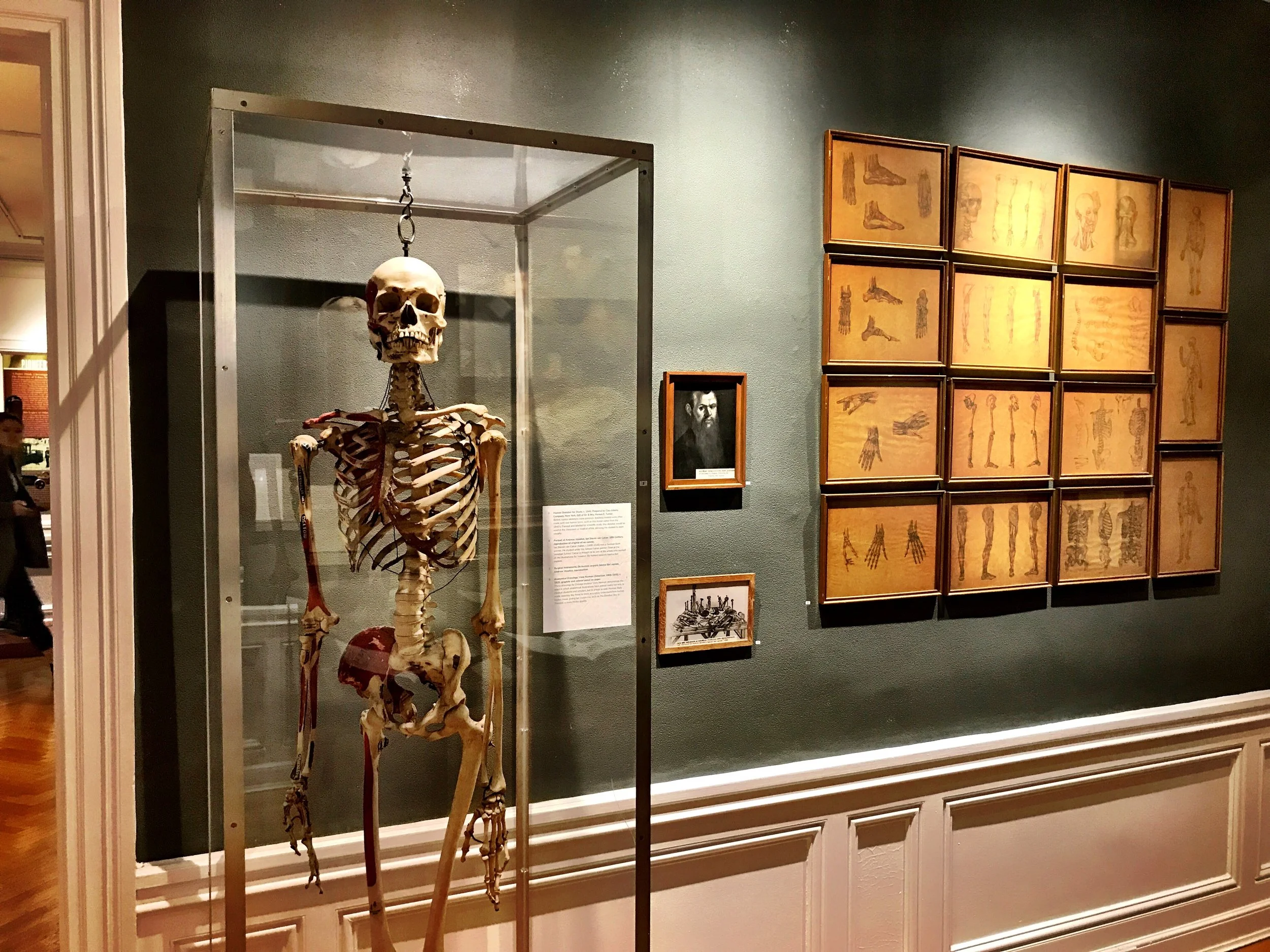Bloodletting and Trepanation: A Tour of the International Museum of Surgical Science