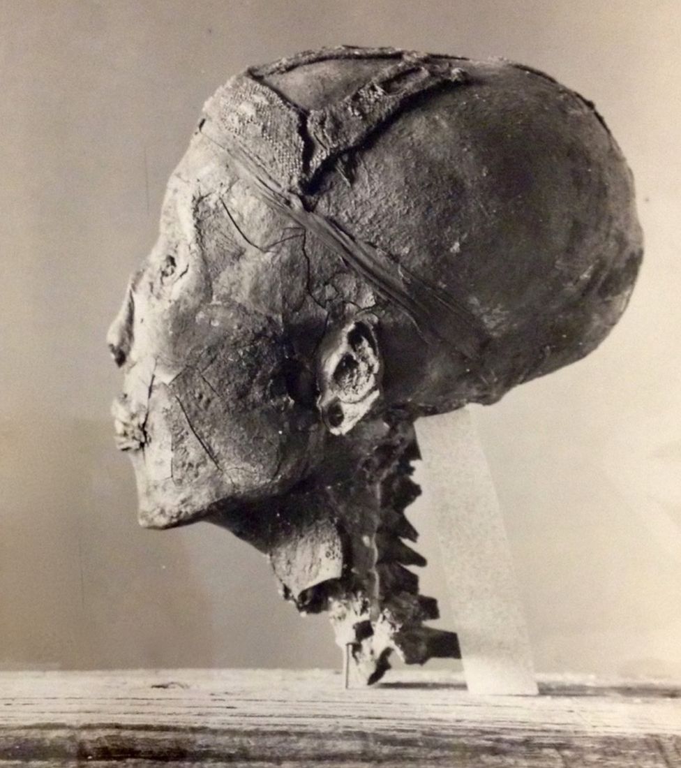 Whoops! Carter and his team accidentally decapitated the Boy King when they took off the funerary mask