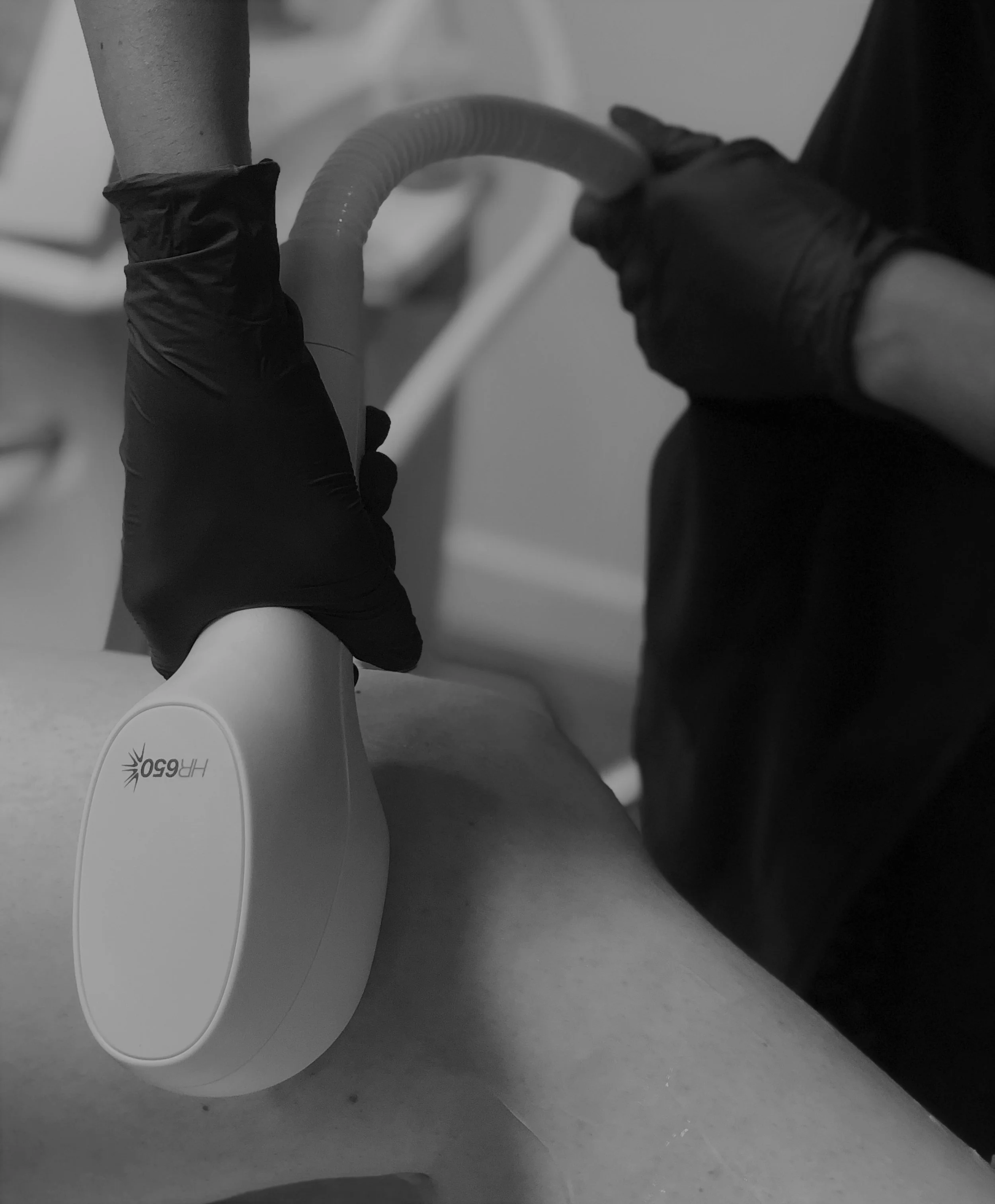 IPL Hair Reduction
