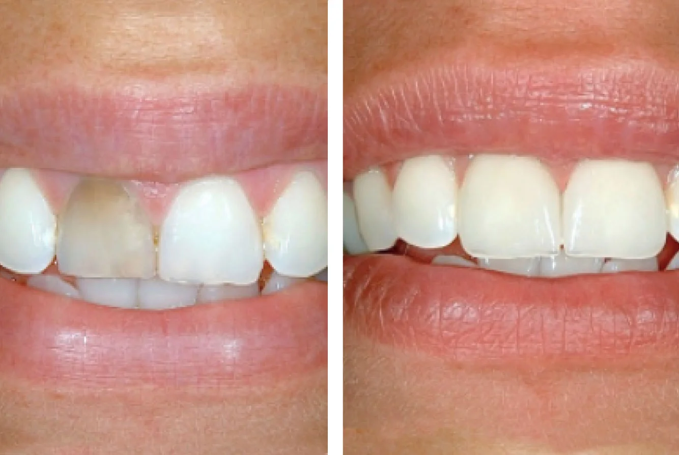 images_cosmetic-contour.jpg