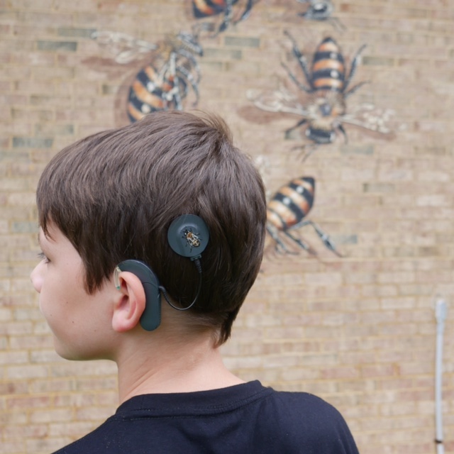 Meet Xander, an 11 year-old boy with a Cochlear Implant. He got the implant put in surgically in May of 2017 and they hooked up the receiver in June. The Good of the Hive was there for it, and later that day I painted a bee on the magnetic disc that connects the implant to the receiver. Xan is now the youngest inspiration of the initiative yet! Personally, I think he is incredible for wanting to do this. I am pretty sure that when I was 11, I would have been trying like hell to make my hearing aid device as unnoticed as possible. But Xan chose to use this challenge to raise awareness (and turn up some volume!) on the issues surrounding honeybees. He is a rockstar in my book no matter how you look at it! This all started while I was on the farm in Nebraska, and attempting to scroll through facebook with little or no internet or cell service. I happened to see a post by his mom, Meghan, offering three choices in color for Xan’s new receiver. He was trying to decide between black, dark grey and white. I (somewhat seriously) commented, “The magnetic part would make a nice little canvas for a bee.” I got a pretty quick response that moved us from somewhat serious to full in. And Xan was inspired by the idea to take it a step further and start talking to people about the bees when they ask him about the receiver. The receiver is a natural attention grabber. And in a battle to keep raising awareness about the bees, creativity and magnetism are key. Xan lives a block away from the mural I painted on the fire station in Carrboro, NC so he knew all about the initiative and the bees and saw this as an opportunity to help. I saw his enthusiasm as an example of the mural working to raise awareness beyond the act of making it! I want the murals to have a life beyond the experience we create while I am there painting. I permanently put bees in place in the hope that they continue to invoke thought and engagement. It was a theory at first, but Xan is an example that it is working. I have also gone back to Estes Hills in Chapel Hill and talked with students about the bees and activist art. I have gone back to Burt’s Bees several times to present… and now Xan is advocating in Carrboro. My painted bees don’t pollinate or sting, but, no matter where I paint, there is always a bee and a story surrounding our connection to these remarkable creatures. Bees communicate through the vibration of the honeycomb in their hives, much like we communicate through talking and listening in our communities. “Hearing” in my layman’s understanding is all about vibration… for us and for the bees. Bees don’t have ears, but they use a section of their antennas to ‘feel’ vibrations in the hive, which translate as a version of hearing for them. They also vibrate their wings in specific ways during several of their dances, which are one of the bees’ most mind-bending forms of communication. The fact that Xan is going to get more than 80% of his hearing back in his left ear is huge with or without a bee on it. But knowing that Xan was motivated to help raise awareness through this challenge speaks to who he is as a human. One man cannot fix the problems for the bees. But one man (or boy) can inspire... and Xan has inspired me to keep looking for unlikely connections. Because sometimes when two unlikely things collide, they create sparks of awareness through curiosity… and where there are sparks there is the possibility of igniting change.