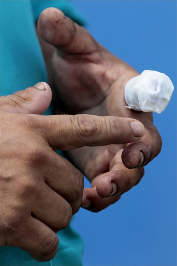  Garcia's finger remains bandaged after it was caught a mechanical tobacco harvester while working. When he can work, Garcia makes about $7 an hour, less than the $7.25 minimum wage. 