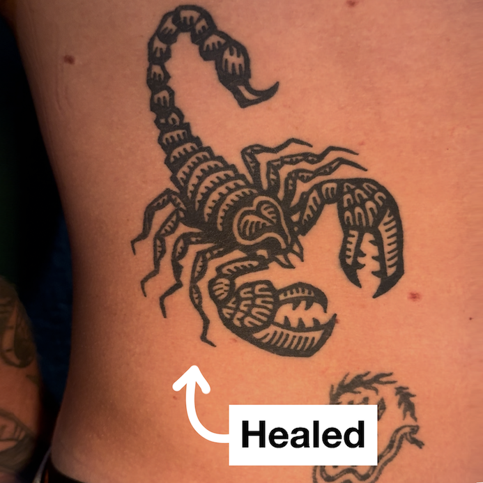 Heal3.png