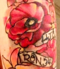 Book Figure 125A. Granddaughter's tattoo.