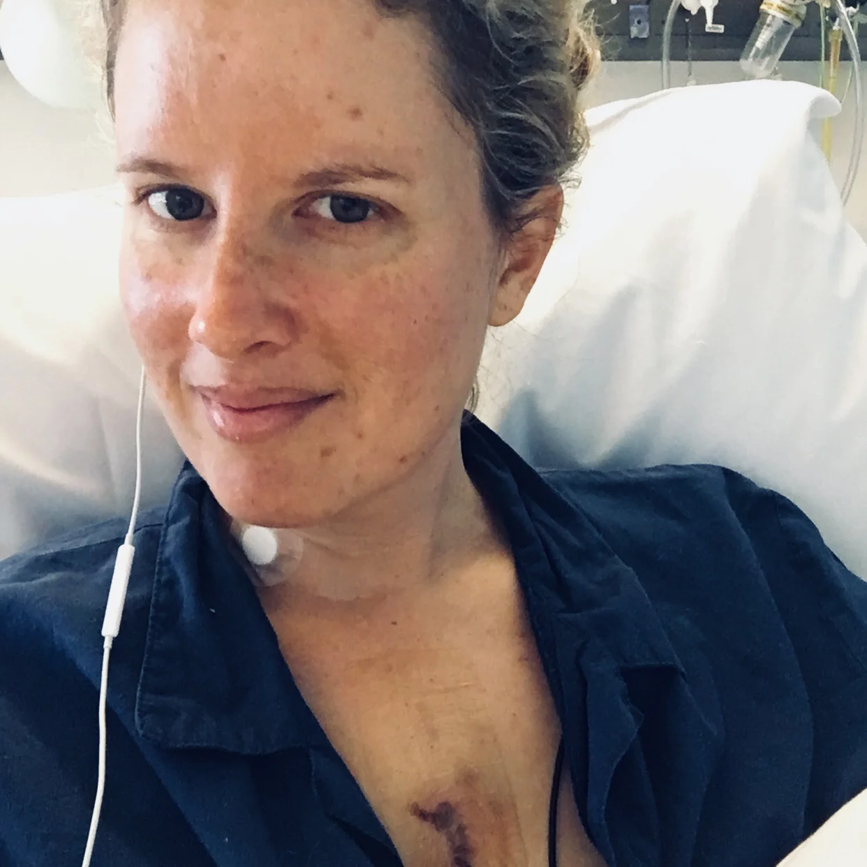 Post-heart surgery selfie.