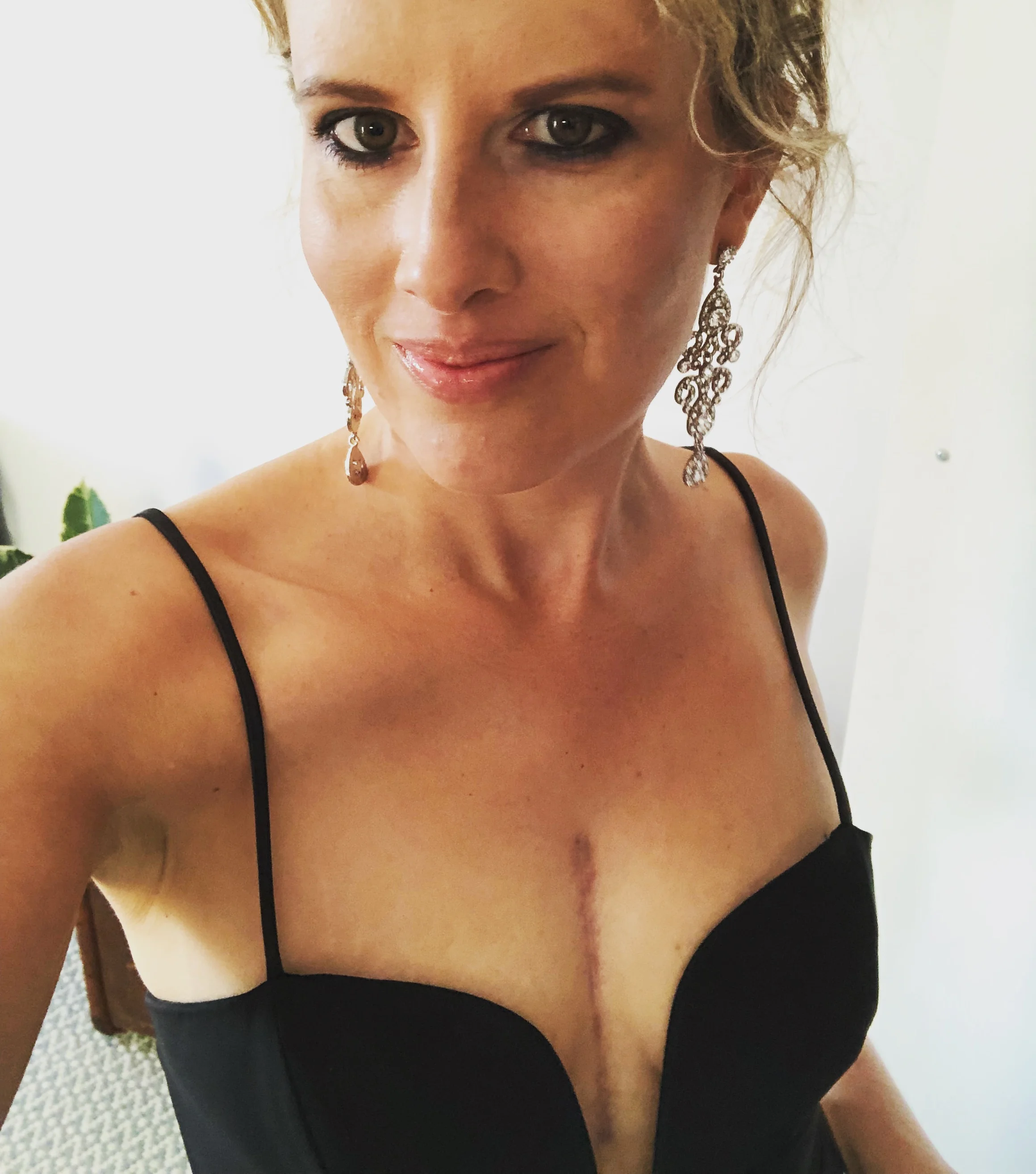 Showing off her scar.