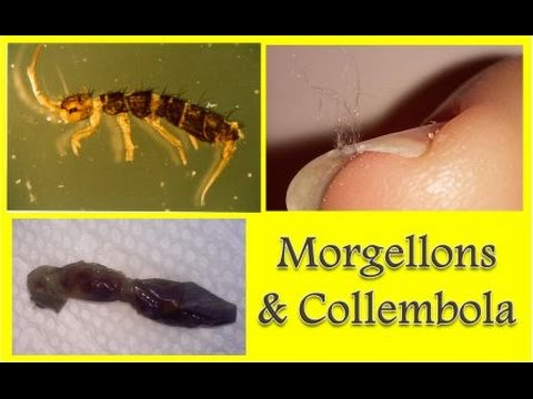 What Every Sugar Land Resident Should Know About Springtail Control