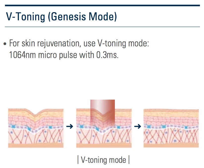 V-Toning.jpg