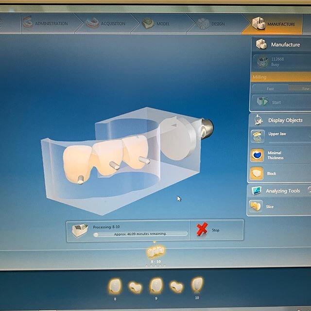 Back when we were repairing some broken teeth... This was the part of the plan, milling a telio cad bridge