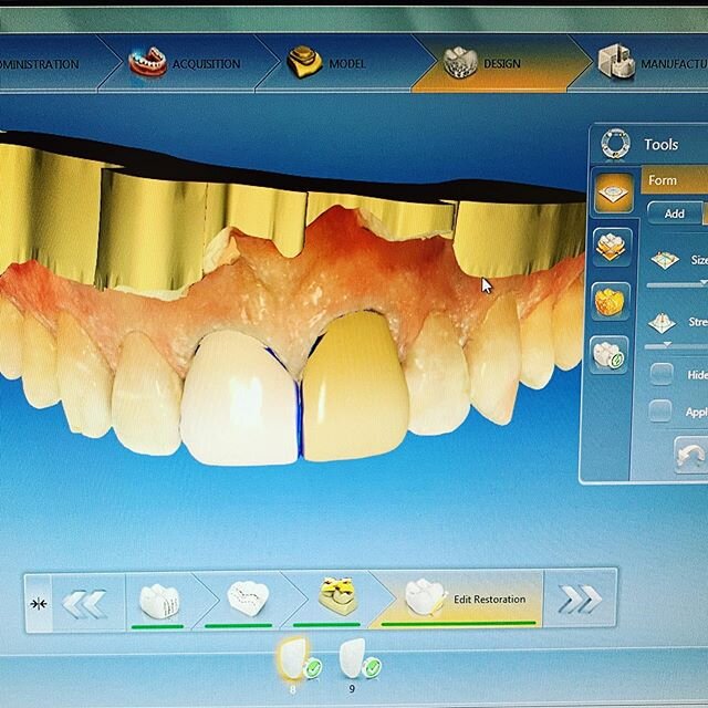 Having fun designing a veneer case!