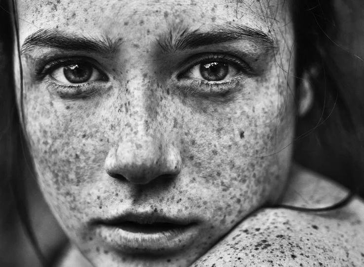 Freckles pigment copy.jpg