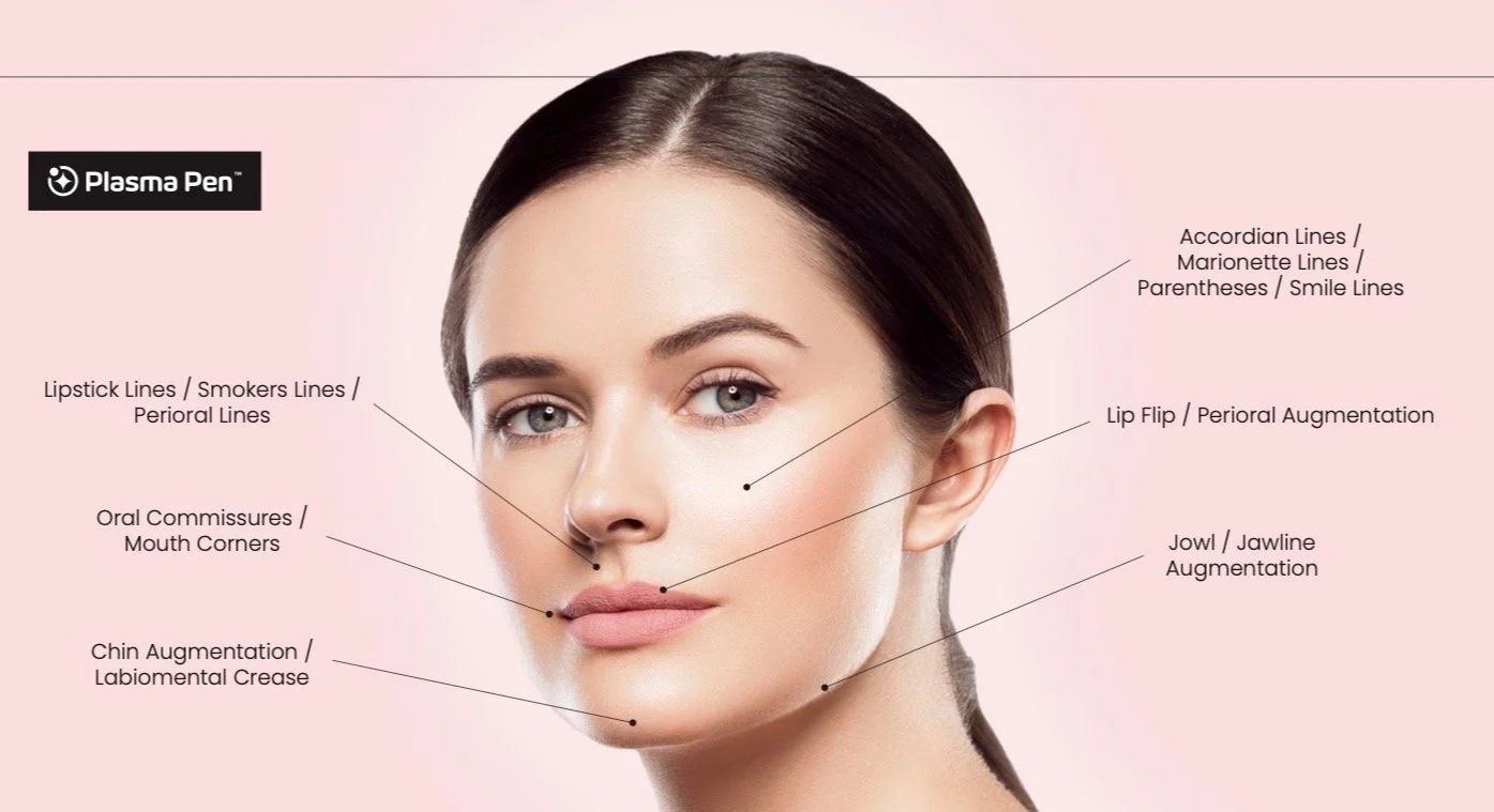 PlasmaPen_Treatment_Guide_Lower_Facial copy.jpg