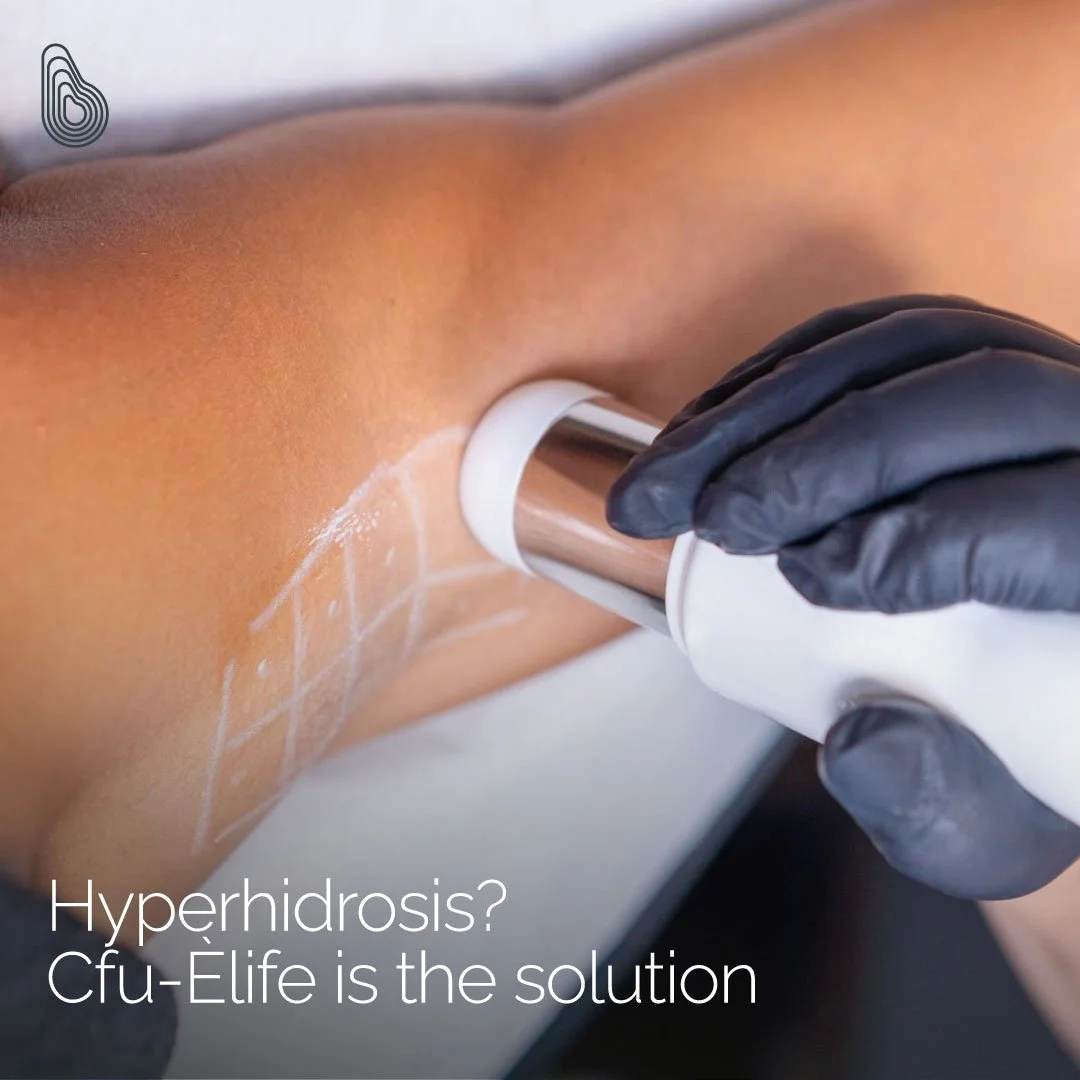 Focused ultrasound treatment for excessive underarm sweating