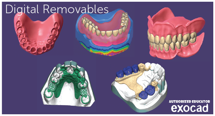 digital-removables-05-04-04.png