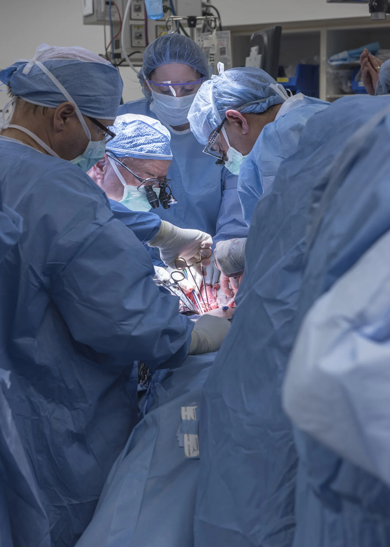 The groundbreaking team of surgeons at work. Photo courtesy of The Cleveland Clinic