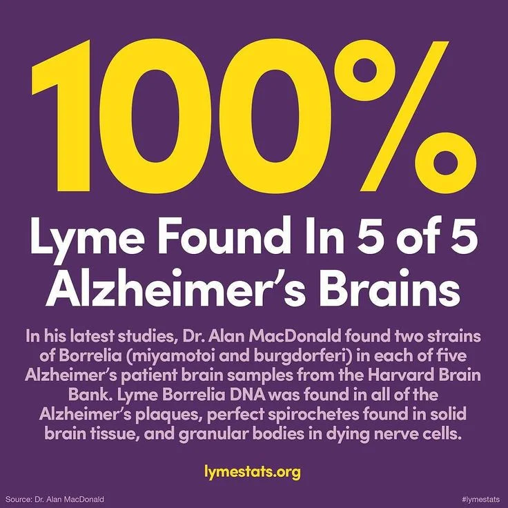 lyme-disease-alzheimers.jpg