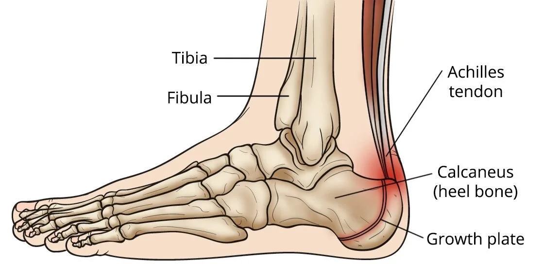 @orthoinfo.aaos.org
